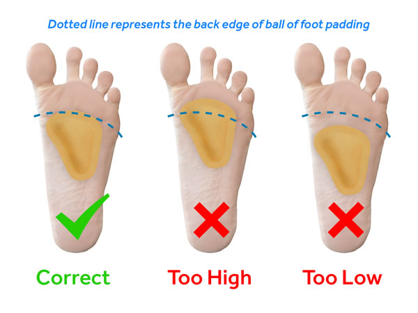 T-Form Metatarsal Pad Positioning metatarsal-pad-placement